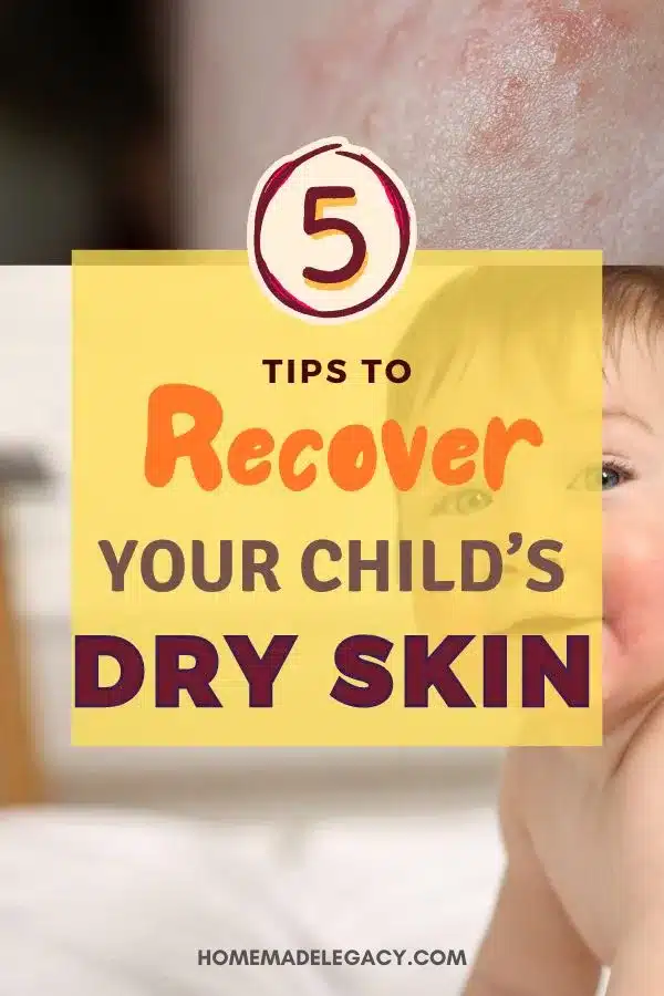 recover child's dry skin