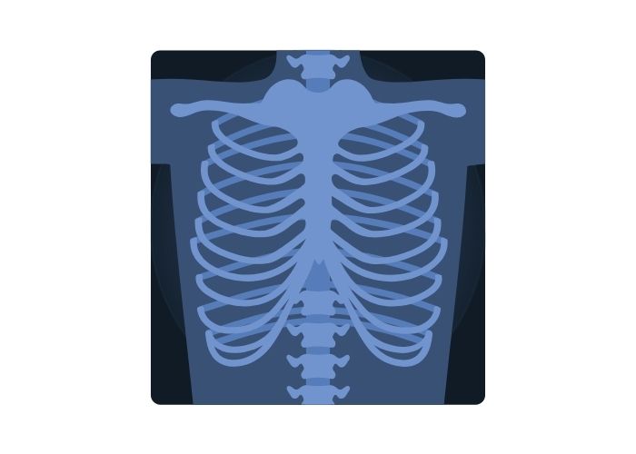 x ray cards activity